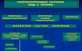 Аденома паращитовидной железы: симптомы, методы лечения