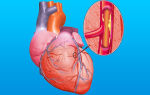 Симптомы сердечных заболеваний — классификация, главные признаки, способы диагностики, лечение