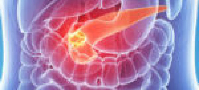 Подпеченочная желтуха: чем характеризуется течение болезни, диагностирование, лечение заболевания различными средствами