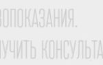 Строение и функции коры головного мозга, способы диагностики аномалии