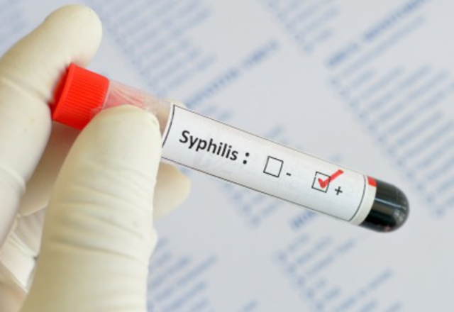 Что такое сифилис, каковы симптомы сифилиса у женщин?