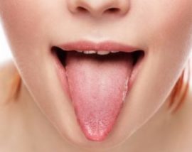 Как убрать налет на языке в домашних условиях без лекарств