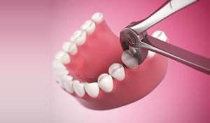 Можно ли удалять зуб при простуде: индивидуальный подход