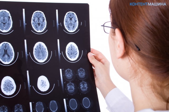 Киста прозрачной перегородки головного мозга: лечение, специфика нехирургических и радикальных методов