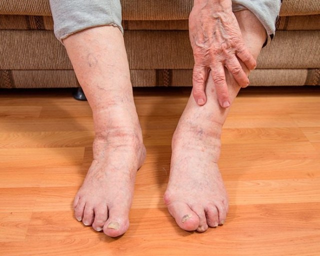 Мерзнет левая нога: симптоматика, основные причины, лечение