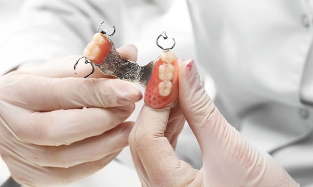 Съемные нейлоновые зубные протезы: отзывы, из чего состоят, когда применяются, противопоказания, уход