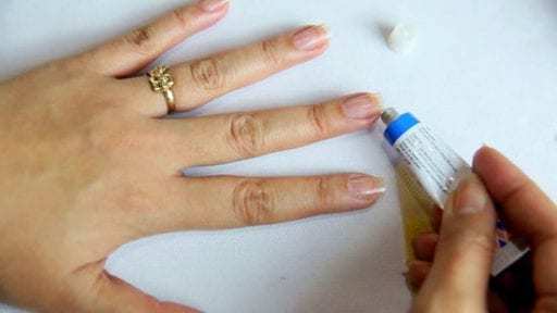Почему трескаются пальцы на руках - что делать в плане лечения и профилактики