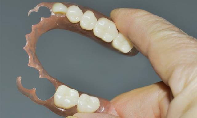 Привыкание к съемным зубным протезам: длительность процесса, упражнения, устранение неприятных симптомов