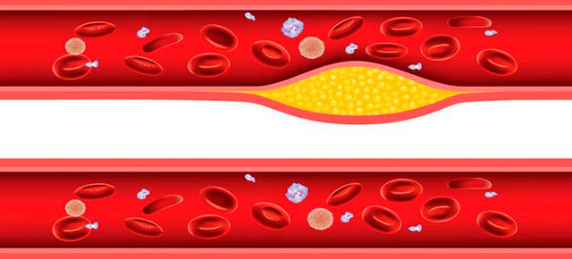 Норма содержания холестерина в крови, функции и свойства, особенности анализа, причины отклонения