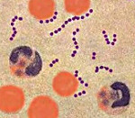 Чем лечить стрептококковую инфекцию и как ее диагностировать?