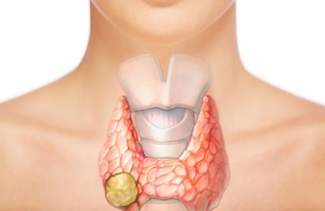 Расшифровка анализа на гормоны щитовидной железы - показания, подготовка и сдача, нормы и отклонения
