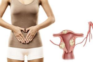 Гипертрофия шейки матки: лечение различными методиками и необходимая диагностика