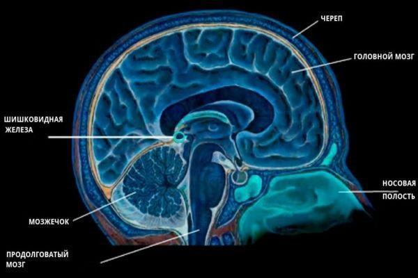 Киста шишковидной железы головного мозга: причины возникновения, симптомы, диагностика и лечение