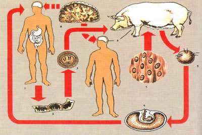 Лечение свиного цепня медикаментами и народными методами, популярные рецепты от обывателей