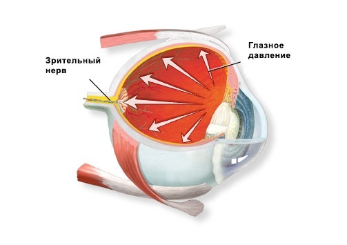 Симптомы давления глазного дна, причины патологии, различные способы лечения в зависимости от тяжести
