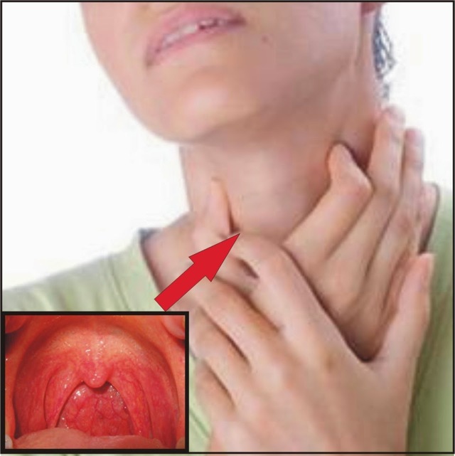 Полоскание горла Фурацилином при ангине: правила применения