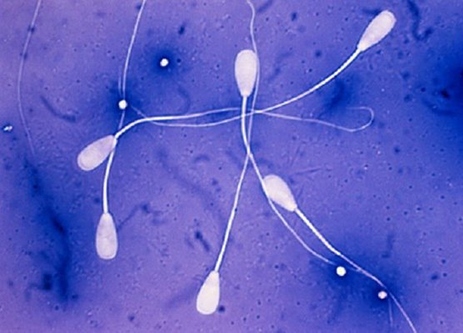 Какой должна быть сперма: причины отклонений
