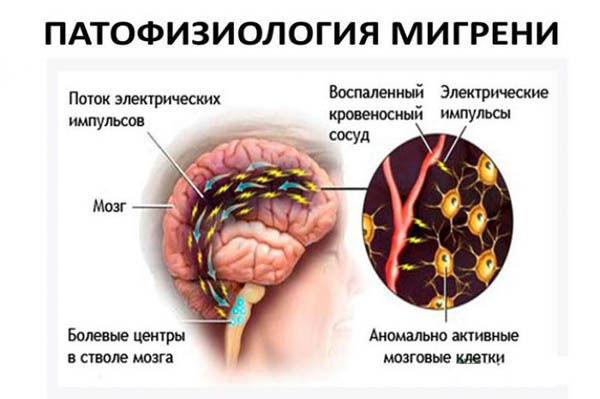 Препараты для сосудов головного мозга: лечение заболеваний
