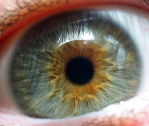 Истончение сетчатки глаза: причины возникновения, симптоматика по разновидностям, методы лечения