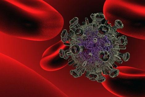 Какие лимфоузлы увеличиваются при ВИЧ? Симптомы патологии