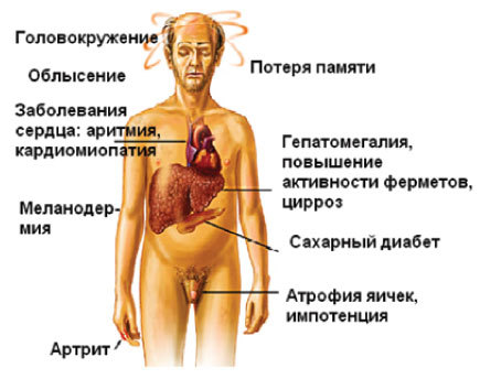 Обмен железа в организме, связанные проблемы, заболевания, лечение, подготовка к анализам
