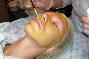 Показания и противопоказания желтого пилинга - так ли безопасна процедура, как уверяют косметологи