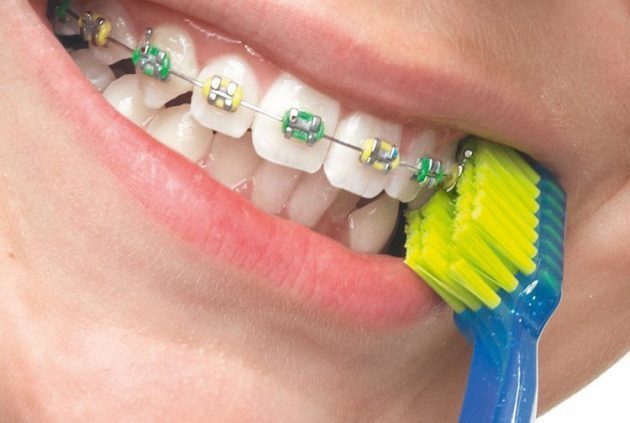 Какая зубная щетка самая лучшая: как выбрать, рекомендации специалистов, правила ухода, классификация