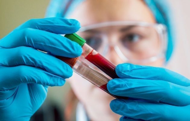 Норма ПТИ в крови - общие сведения, подготовка и проведение анализа, причины отклонения показателя