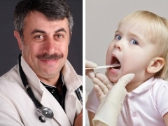 Как лечить хронический тонзиллит у ребенка: советы врачей
