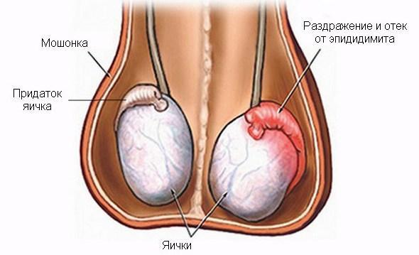 Симптомы уреаплазмоза у мужчин - губительное влияние на мочевыделительную и половую систему