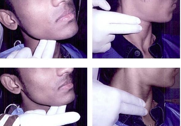 Как выглядят воспаленные лимфоузлы на шее, что делать при их наличии и насколько это опасно
