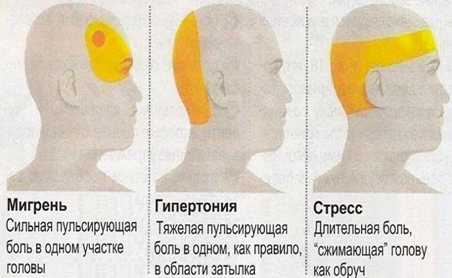 Болит голова слева: причины и признаки недуга, возможные заболевания, специфика диагностики, лечение