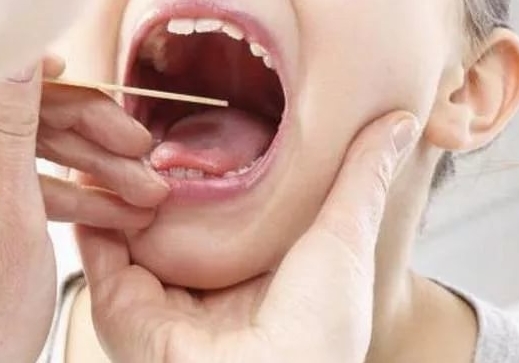 Чем перебить запах лука изо рта: как добиться свежести