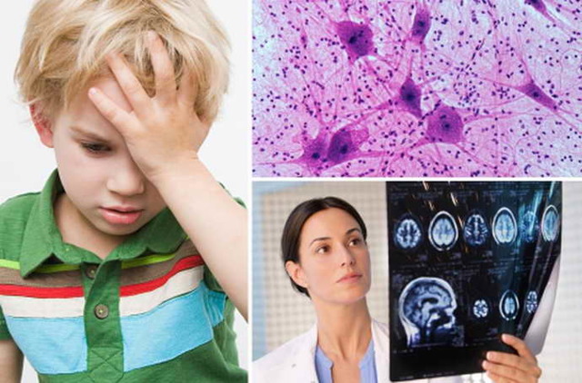 Симптомы менингита у ребенка - основные признаки, виды патологии, способы лечения, осложнения