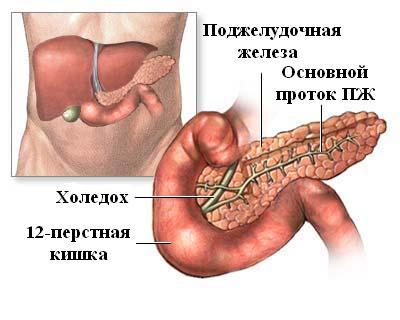 Симптомы острого панкреатита у взрослых: описание, лечение