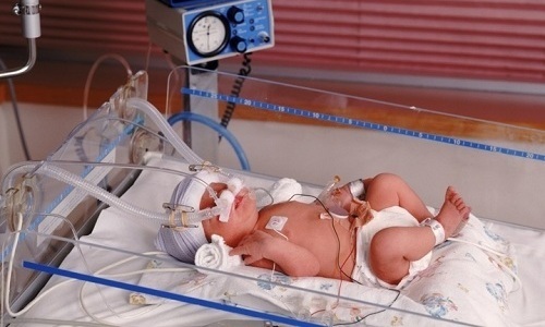 Грыжа новорожденных: симптомы, причины, лечебные методики