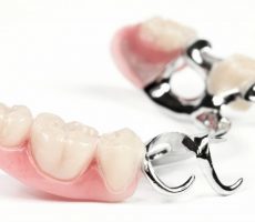 Съемные нейлоновые зубные протезы: отзывы, из чего состоят, когда применяются, противопоказания, уход