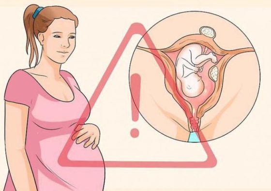 Можно ли забеременеть при эндометриозе матки: причины заболевания и его влияние на репродуктивные функции