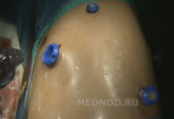 Торакальная хирургия в Москве: операции и методы диагностики