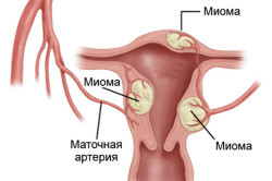 Что такое миометрий: роль и его функция в организме женщины