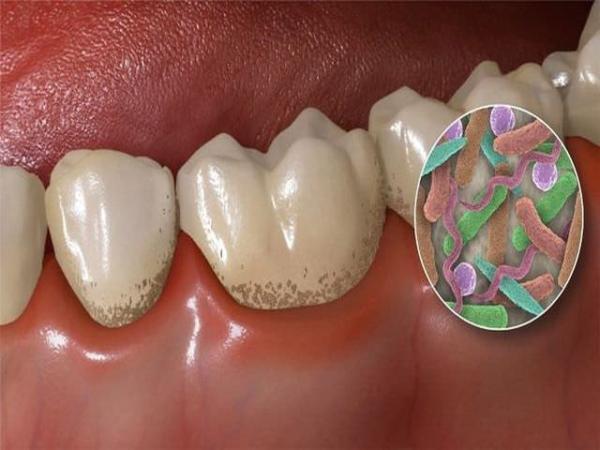 Можно ли отбелить зубы содой - эффективные способы, рекомендации специалистов