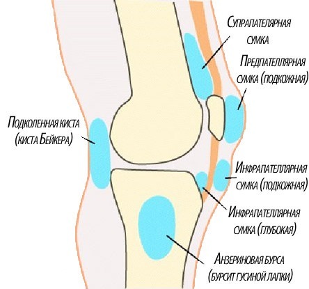 Бурсит коленного сустава: лечение народными средствами, причины, симптомы и профилактика