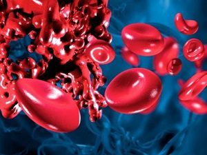 Препараты для разжижения крови - особенности применения, противопоказания и возможные побочные эффекты