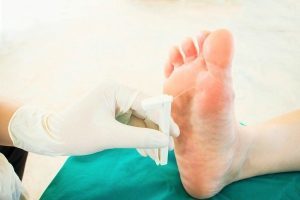 Почему появляются пузырьки на пальцах ног и как от них избавиться