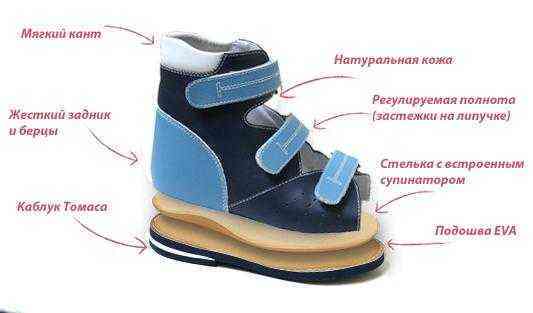 Какую обувь носить при плоскостопии при различных стадиях развития патологии