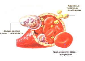 Почему повышаются лейкоциты в крови: причины и признаки лейкоцитоза, способы нормализации состава крови