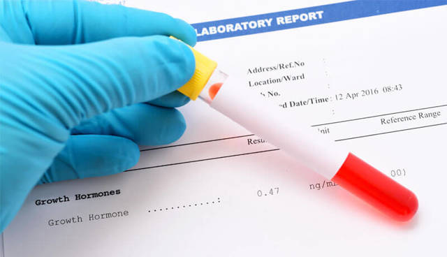 Расшифровка анализа на гормоны щитовидной железы - показания, подготовка и сдача, нормы и отклонения