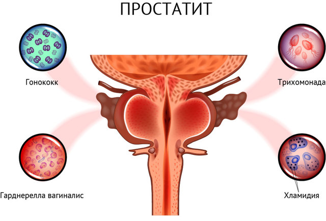 Боль в мочеиспускательном канале - возможные заболевания, сопутствующие симптомы, способы лечения